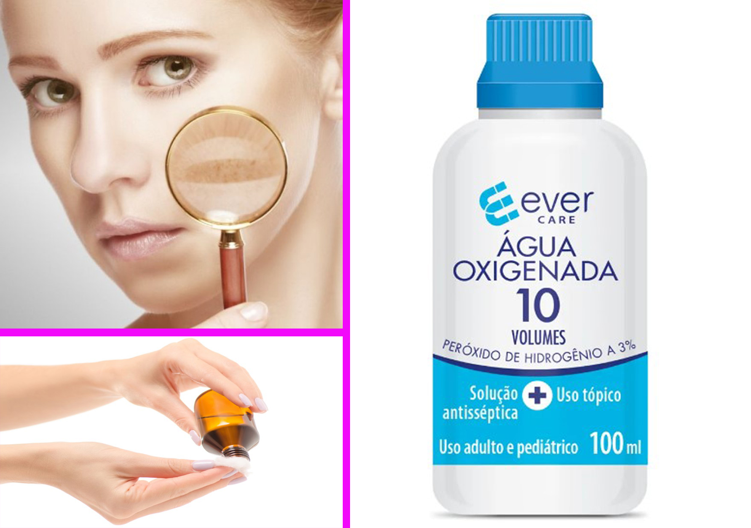 Agua Oxigenada Para La Cara Manchas Axilas Entrepierna Hongos