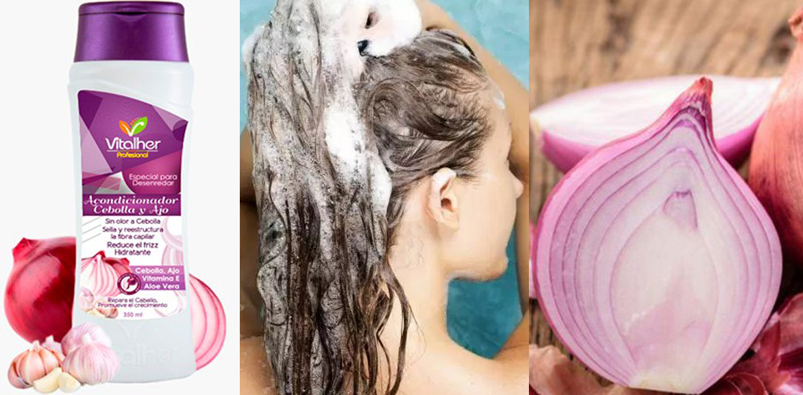 Shampoo de Cebolla Para Qué Sirve【Canas, Caspa, Caída y Más】